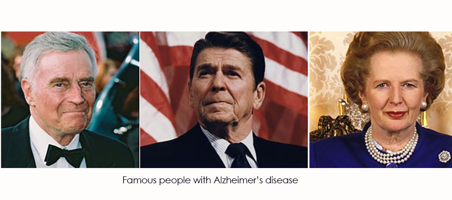 Famous People with Alzheimer 